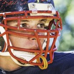 Concussions and Brain Injury Affecting Personal Injury Law.